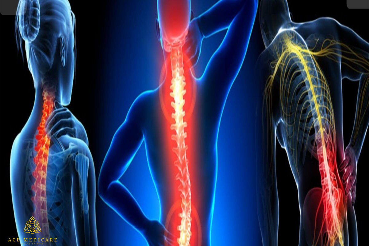 Spinal Surgery and Lifestyle Modifications: Creating a Supportive Environment for Healing